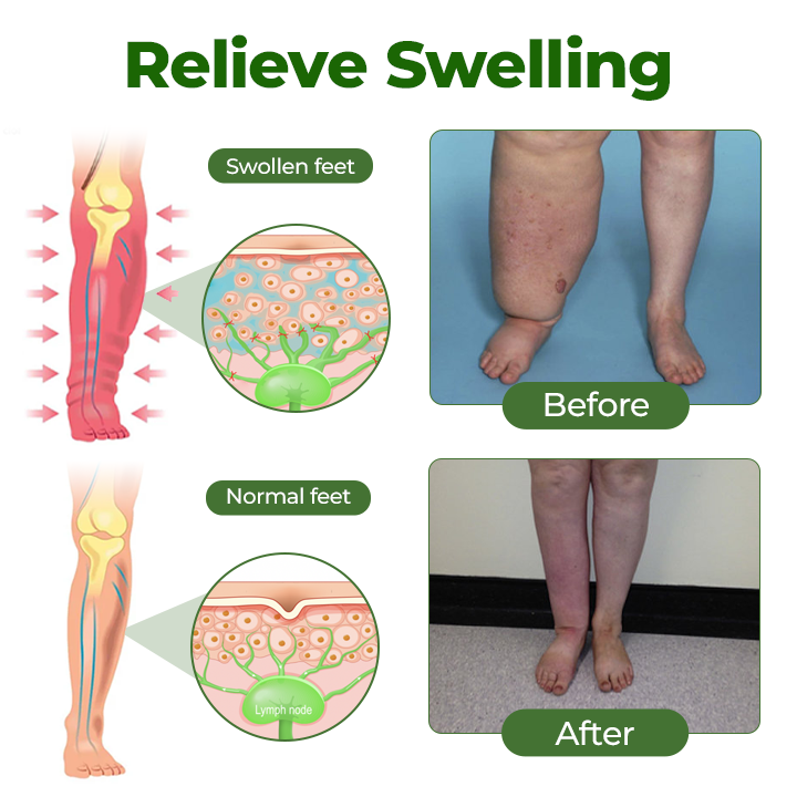 Glowrizon® Professional Leg Circulation Cream