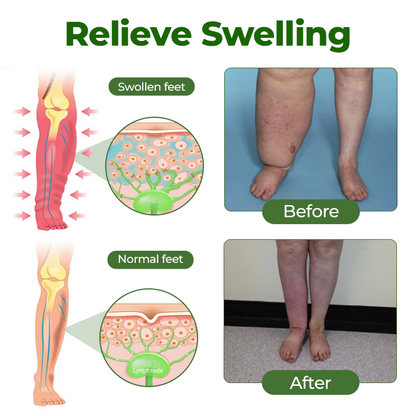 Glowrizon® Professional Leg Circulation Cream