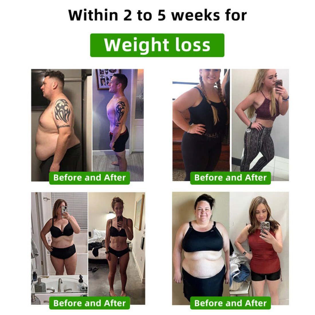 🐝🐝LOVILDS™ Bee Venom Lymphatic Drainage Slimming Foot Patch🔥Limited time 50% OFF🔥（Suitable for use by individuals of all ages)