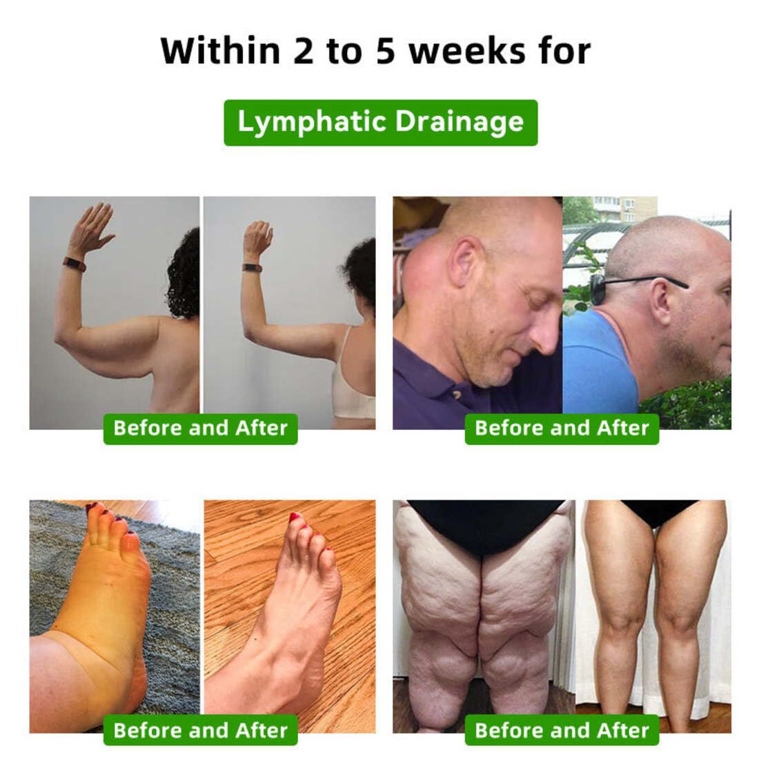 🐝🐝LOVILDS™ Bee Venom Lymphatic Drainage Slimming Foot Patch🔥Limited time 50% OFF🔥（Suitable for use by individuals of all ages)